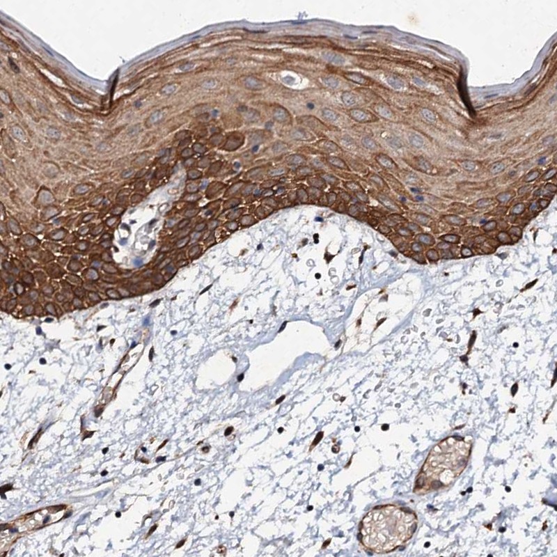 Atlas Antibodies Anti-ADAMTS10 Antibody