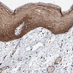 Atlas Antibodies Anti-ADAMTS10 Antibody