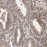 Atlas Antibodies Anti-ADAMTS2 Antibody
