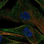 Atlas Antibodies Anti-ADAMTS2 Antibody