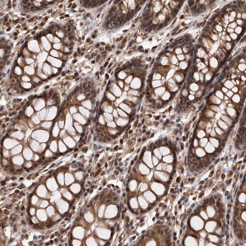Atlas Antibodies Anti-ADAMTS20 Antibody