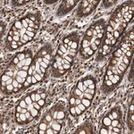 Atlas Antibodies Anti-ADAMTS20 Antibody