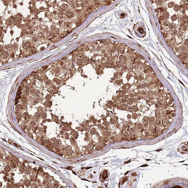 Atlas Antibodies Anti-ADAMTS3 Antibody