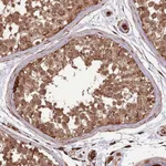 Atlas Antibodies Anti-ADAMTS3 Antibody