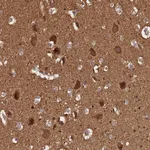 Atlas Antibodies Anti-ADAMTS18 Antibody