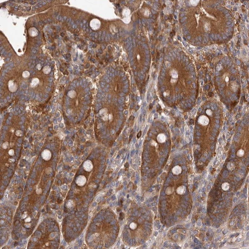 Atlas Antibodies Anti-ADAMTS20 Antibody