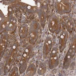 Atlas Antibodies Anti-ADAMTS20 Antibody