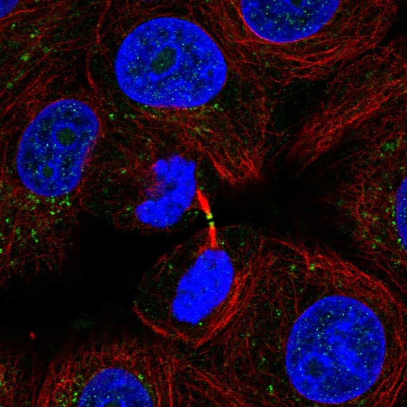 Atlas Antibodies Anti-ADAMTS19 Antibody
