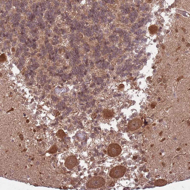 Atlas Antibodies Anti-ADAMTS3 Antibody