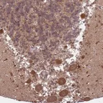 Atlas Antibodies Anti-ADAMTS3 Antibody