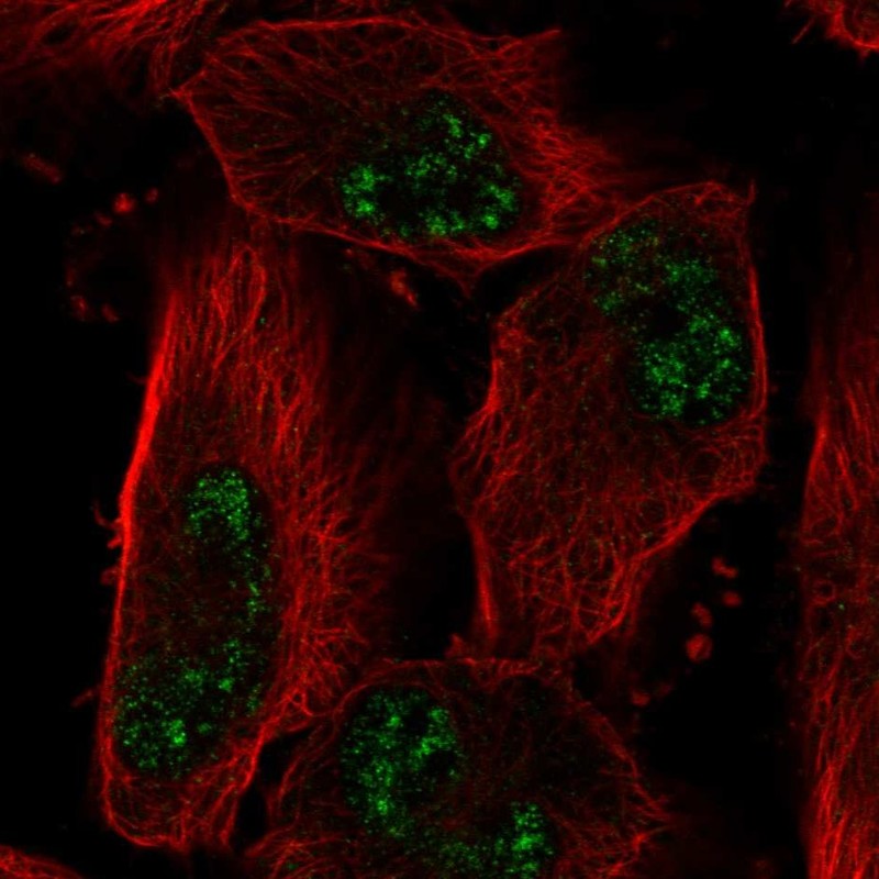 Atlas Antibodies Anti-ADAMTS4 Antibody