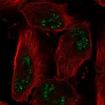 Atlas Antibodies Anti-ADAMTS4 Antibody