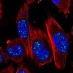 Atlas Antibodies Anti-ADAMTS4 Antibody