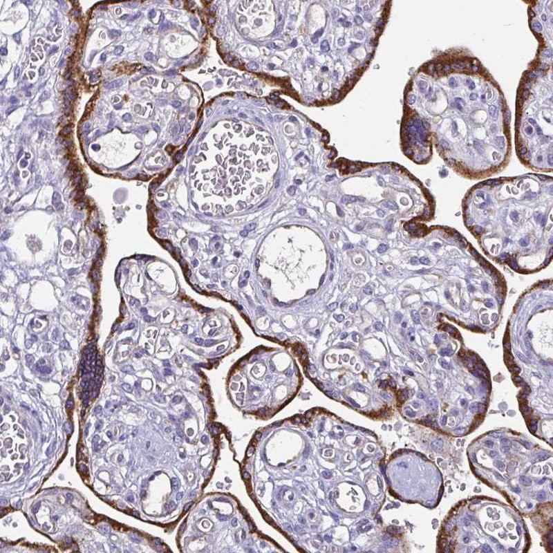 Atlas Antibodies Anti-ADAMTS6 Antibody