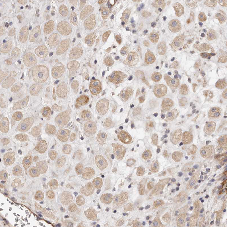 Atlas Antibodies Anti-ADAMTS9 Antibody