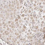 Atlas Antibodies Anti-ADAMTS9 Antibody