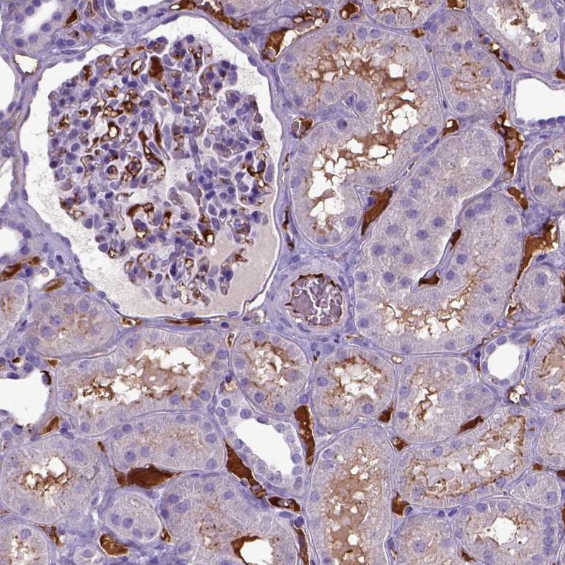 Atlas Antibodies Anti-ADAMTS8 Antibody