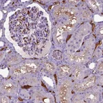 Atlas Antibodies Anti-ADAMTS8 Antibody