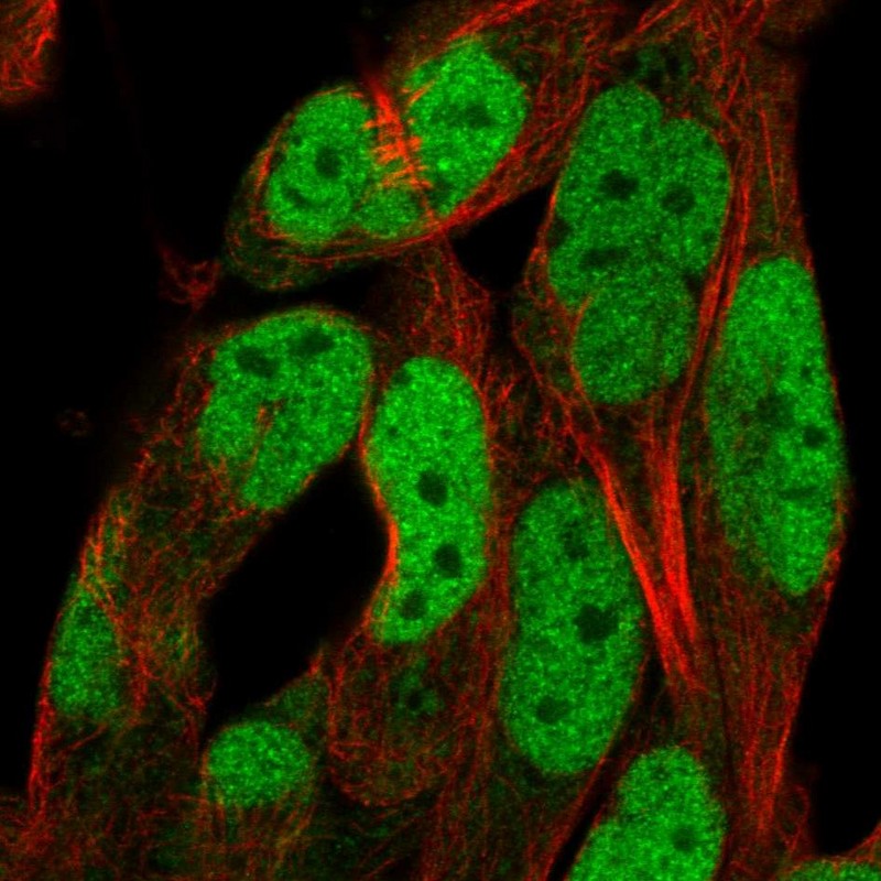 Atlas Antibodies Anti-ADAMTS5 Antibody