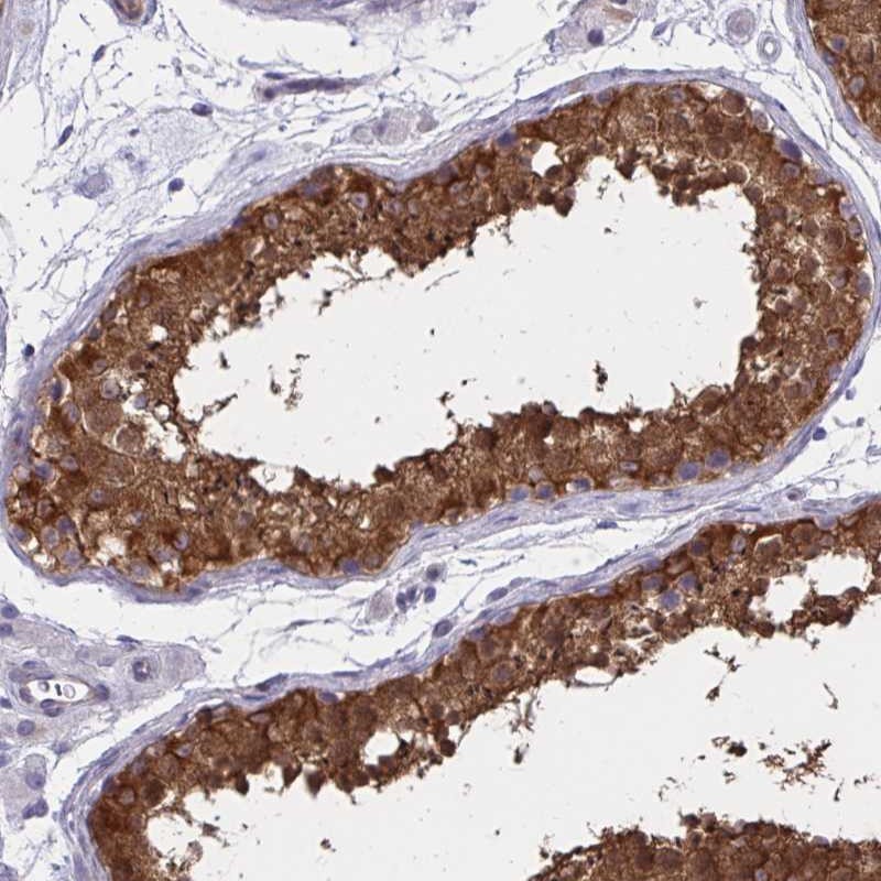 Atlas Antibodies Anti-ADAMTSL1 Antibody