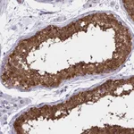 Atlas Antibodies Anti-ADAMTSL1 Antibody