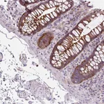Atlas Antibodies Anti-ADAMTSL2 Antibody