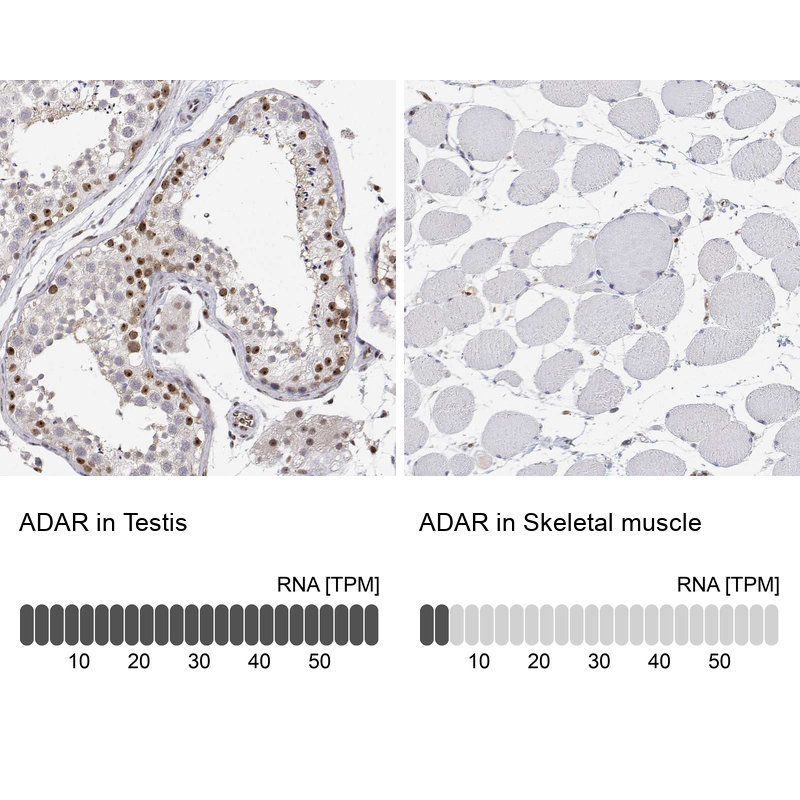 Atlas Antibodies Anti-ADAR Antibody