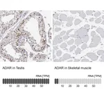 Atlas Antibodies Anti-ADAR Antibody
