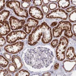 Atlas Antibodies Anti-ADAT1 Antibody