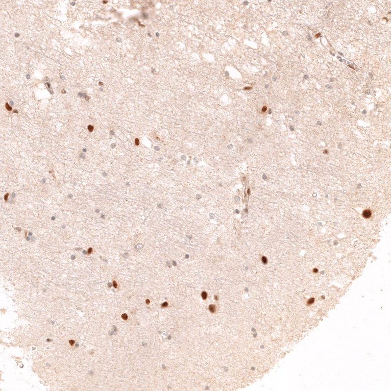 Atlas Antibodies Anti-ADARB1 Antibody