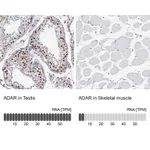 Atlas Antibodies Anti-ADAR Antibody