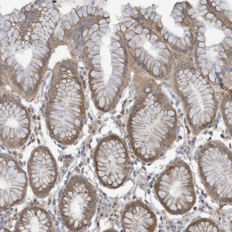 Atlas Antibodies Anti-ADAT2 Antibody