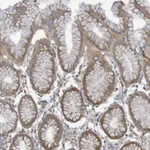 Atlas Antibodies Anti-ADAT2 Antibody