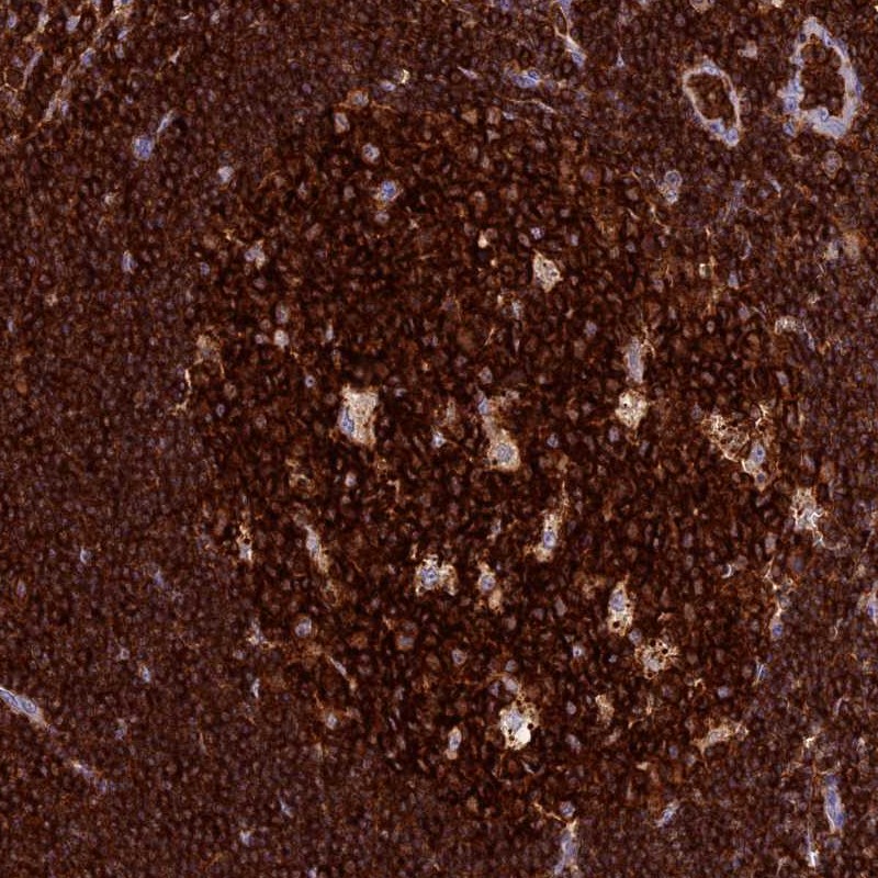 Atlas Antibodies Anti-ADAT1 Antibody