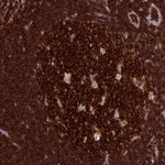 Atlas Antibodies Anti-ADAT1 Antibody