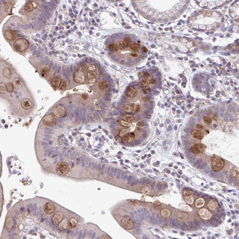 Atlas Antibodies Anti-ADAT3 Antibody