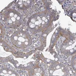 Atlas Antibodies Anti-ADCK1 Antibody