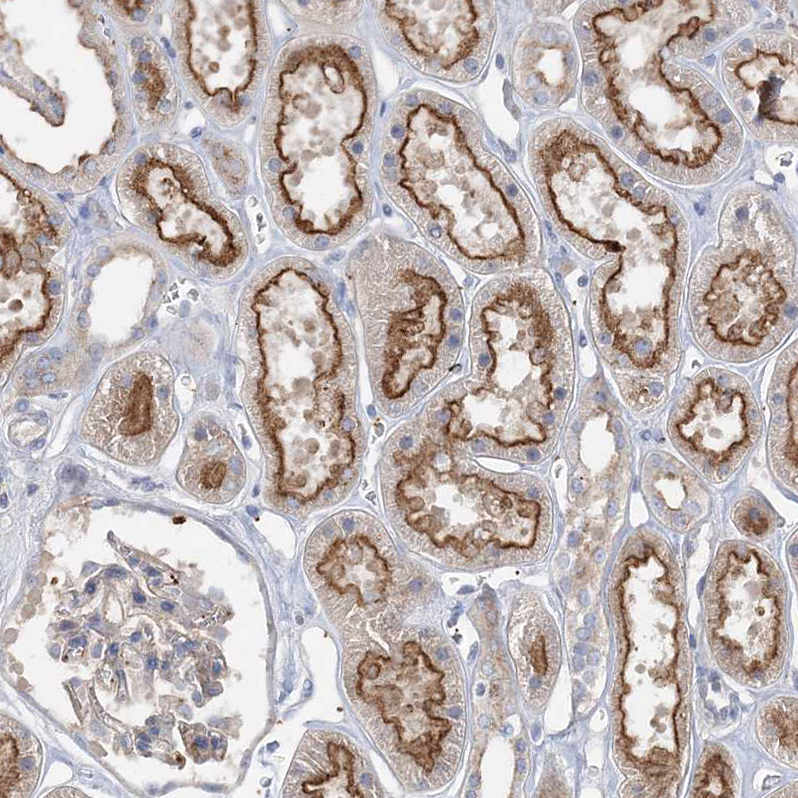 Atlas Antibodies Anti-ADCK2 Antibody