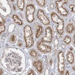 Atlas Antibodies Anti-ADCK2 Antibody