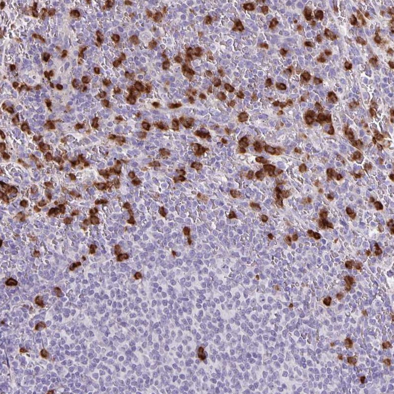 Atlas Antibodies Anti-ADCK1 Antibody