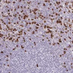 Atlas Antibodies Anti-ADCK1 Antibody