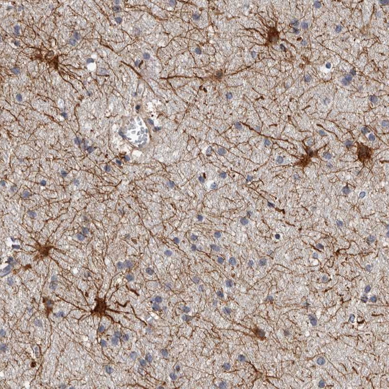 Atlas Antibodies Anti-ADCK5 Antibody