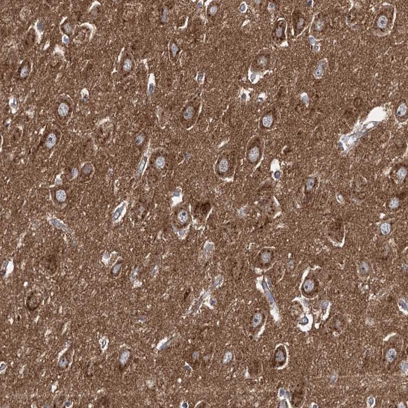 Atlas Antibodies Anti-ADCY2 Antibody