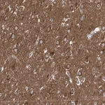 Atlas Antibodies Anti-ADCY2 Antibody