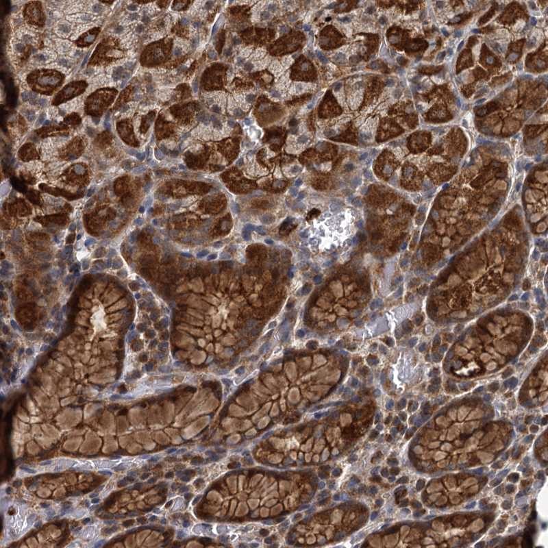 Atlas Antibodies Anti-ADCY2 Antibody