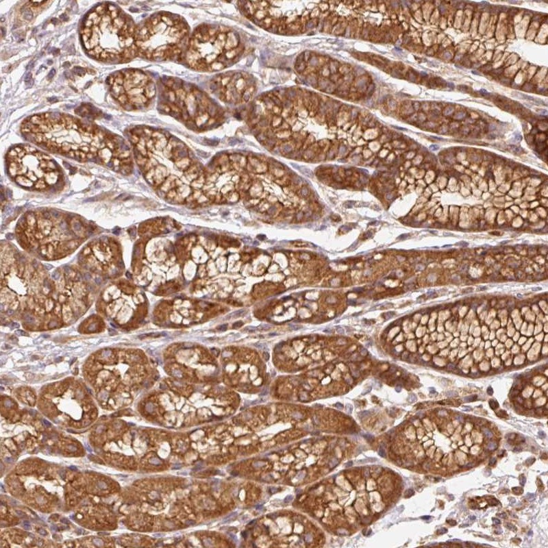 Atlas Antibodies Anti-ADCY4 Antibody