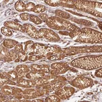 Atlas Antibodies Anti-ADCY4 Antibody