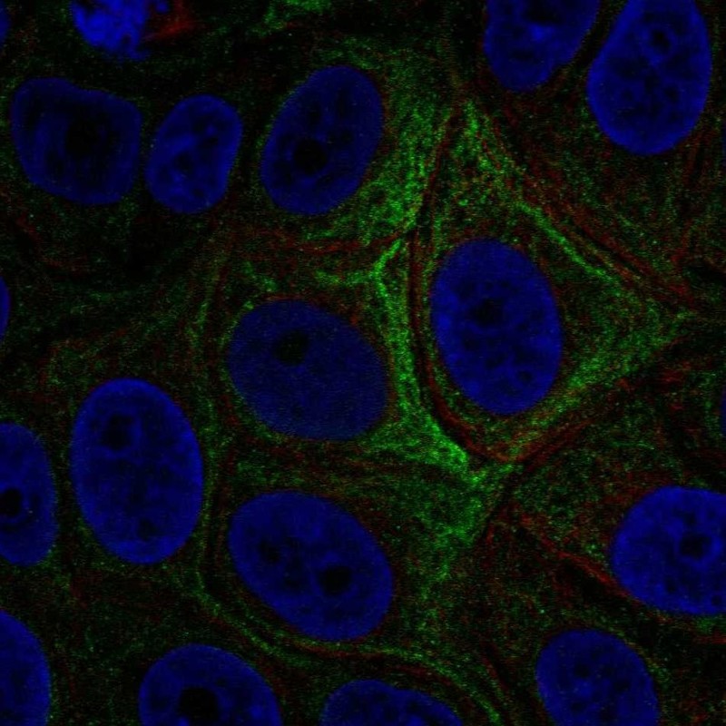 Atlas Antibodies Anti-ADCY5 Antibody