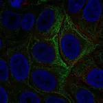Atlas Antibodies Anti-ADCY5 Antibody