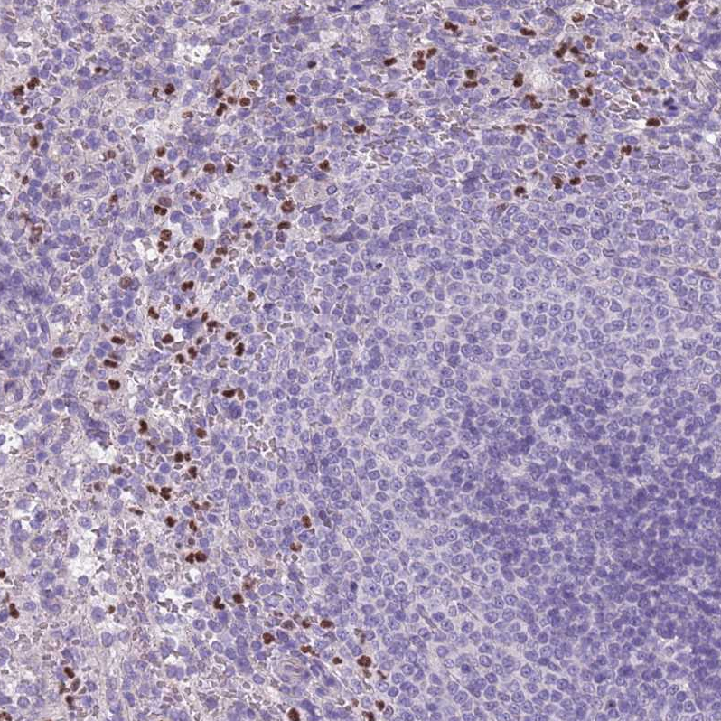 Atlas Antibodies Anti-ADCY7 Antibody